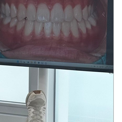 스케일링주기 치과 보험까지 확인 관련 이미지 8