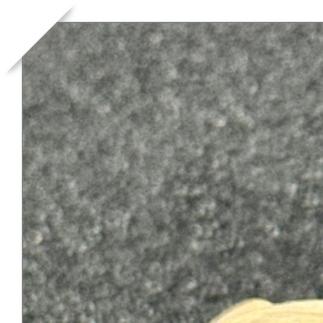 이빨씌우는가격 종류별 차이 관련 이미지 4