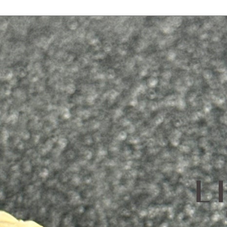 이빨씌우는가격 종류별 차이 관련 이미지 5