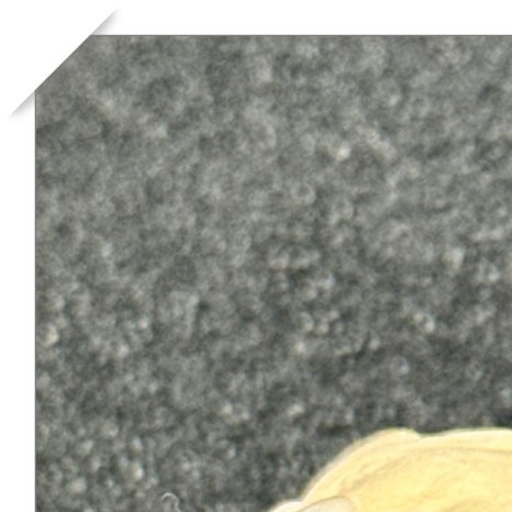 윗니 부분 교정 장단점 정리 관련 이미지 3