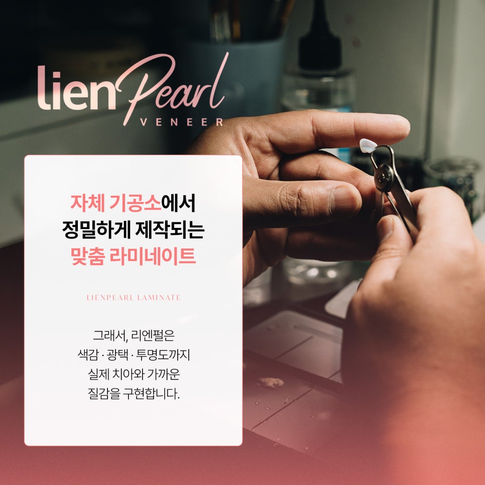 강남역 라미네이트, 제대로 알아보고 싶다면? 관련 이미지 6
