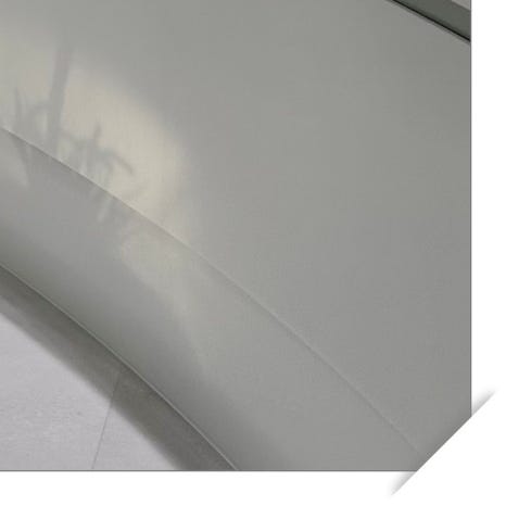 치과레진 치료의 장단점 관련 이미지 11