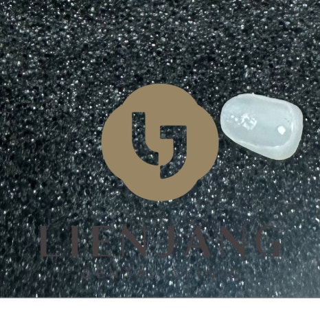 치과보철물 종류별 가격과 특징 관련 이미지 10