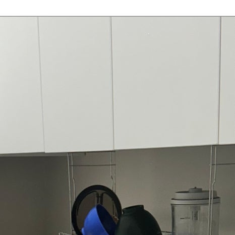 매복사랑니발치후기 읽고 걱정하셨다면 관련 이미지 4