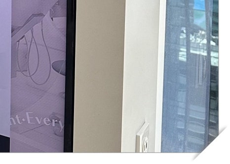 효창동임플란트 뼈 이식까지 생각한다면 관련 이미지 12