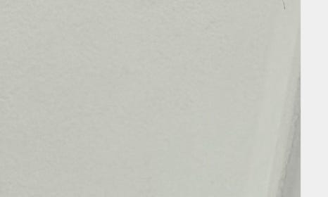 개포임플란트 맞춤형으로 튼튼하게 관련 이미지 42