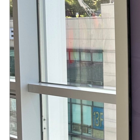 다산동임플란트 비용 부담 줄이려면 관련 이미지 7