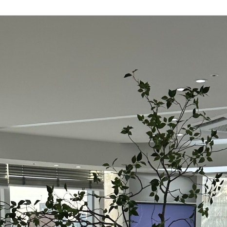 서울라미네이트 치료 과정 정리 관련 이미지 4