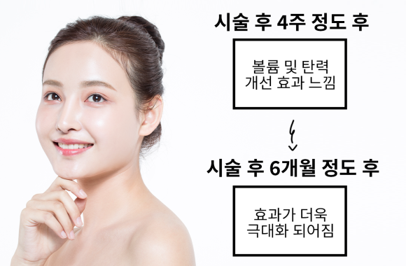 압구정 스컬트라 시술 콜라겐 부스터 효과 정보까지 관련 이미지 3