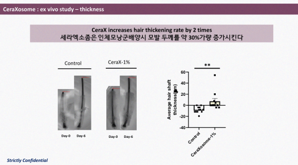 Hair Loss Treatment with Cella Exosome? It Promotes Hair Thickness and Growth Speed. <Real Clinical Results Revealed> image 7