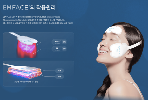 눈처짐 비수술 해결법, 엠페이스와 아이써마지 복합 치료의 원리 관련 이미지 5