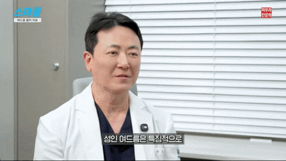 성인 여드름 원인과 흉터 치료까지 총정리 관련 이미지 2