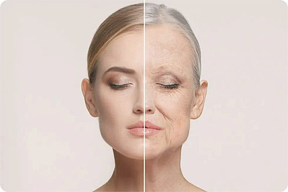 눈처짐, 단순히 눈꺼풀 문제일까요? 엠페이스&middot;아이써마지&middot;스컬트라로 개선하는 방법 관련 이미지 2