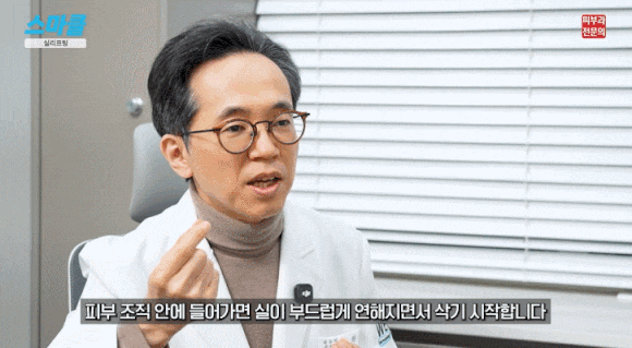 효과 좋은 실리프팅 vs 효과 없는 실리프팅의 차이는 ‘이것’ (효과, 유지 기간, 추천대상) 관련 이미지 5