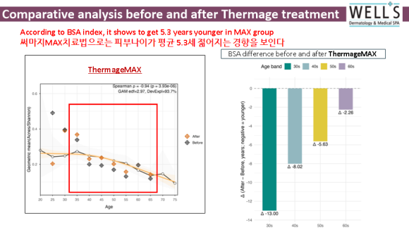 웰스피부과 써마지 FLX, 피부 나이 5.3세 젊어지는 연구결과 공개 관련 이미지 8