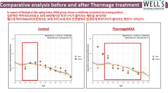 Thermage Lifting: Research Results Showing Skin Age Rejuvenated by 5.3 Years. <Thermage MAX> image 8