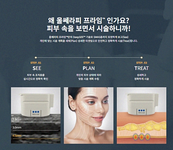 Worried about swelling and pain after Apgujeong Ulthermage? 3 key things to check before the procedure image 4