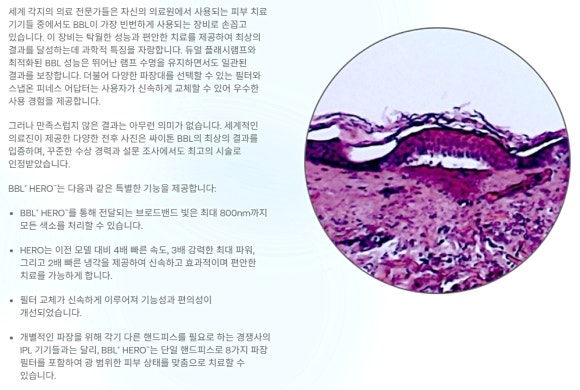 How BBL Laser in Apgujeong Improves Melasma and Spots, from Effects to Aftercare image 6