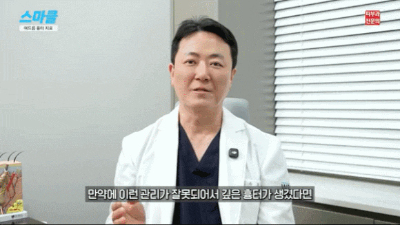 성인 여드름 원인과 흉터 치료까지 총정리 관련 이미지 9