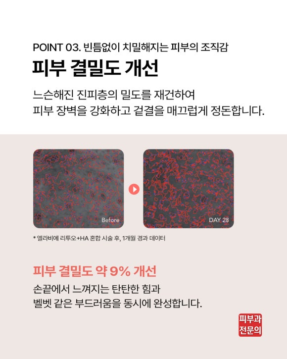 웰스피부과 엘라비에 리투오 압구정 스킨부스터 핵심 및 효과는? 관련 이미지 7