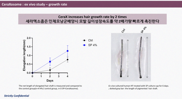 Hair Loss Treatment with Cella Exosome? It Promotes Hair Thickness and Growth Speed. <Real Clinical Results Revealed> image 8