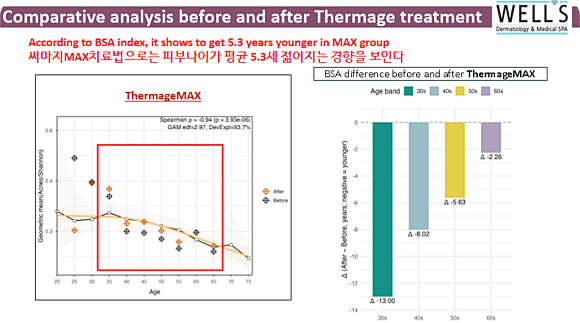 Thermage Lifting: Research Results Showing Skin Age Rejuvenated by 5.3 Years. <Thermage MAX> image 9