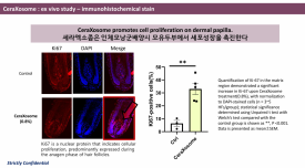 Hair Rejuvenation Therapy: Reviving Hair Vitality with Cera Exosome and Ditology NMN image 7