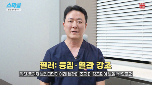 Under-Eye Hollowing Collagen Injections? We’ll Answer All Your Questions. <feat. Sculptra, Rituo, Rejuran> image 3