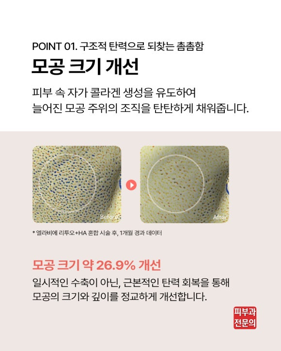 웰스피부과 엘라비에 리투오 압구정 스킨부스터 핵심 및 효과는? 관련 이미지 5
