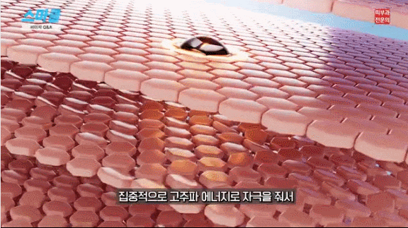써마지, 효과 없이 돈만 날리지 않으려면? ( 3가지 핵심 노하우 ) 관련 이미지 3