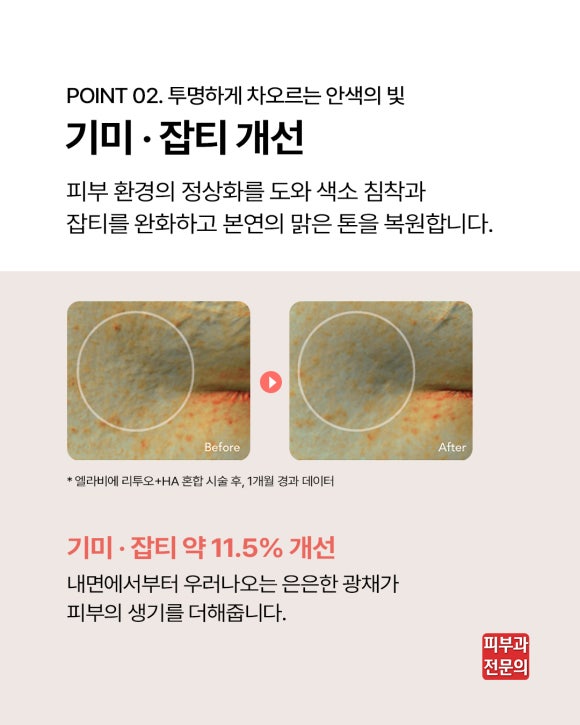 웰스피부과 엘라비에 리투오 압구정 스킨부스터 핵심 및 효과는? 관련 이미지 6