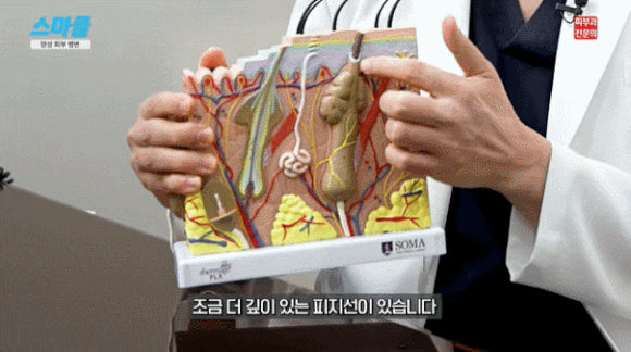 얼굴에 오돌토돌 올라오는 것, 다 같은 게 아닙니다 <한관종, 비립종, 피지증식증, 편평사마귀> 관련 이미지 4