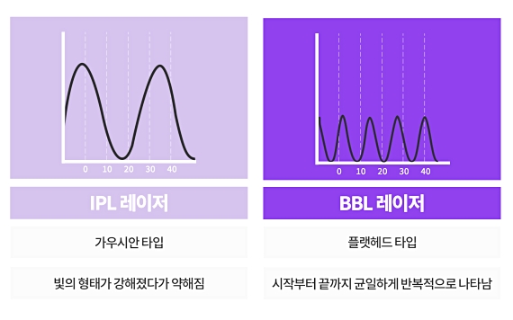압구정역 BBL레이저, 여름 오기 전 잡티 삭제 변화를 원한다면 관련 이미지 3