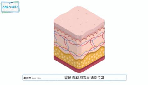 울쎄라 수면마취, 꼭 해야 할까요? 피부과 전문의가 말하는 통증 조절법 관련 이미지 8
