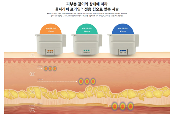울쎄라와 피팅 리프팅, 왜 &lsquo;같이&rsquo; 해야 더 좋을까요? <울쎄라프라임핏> 관련 이미지 8