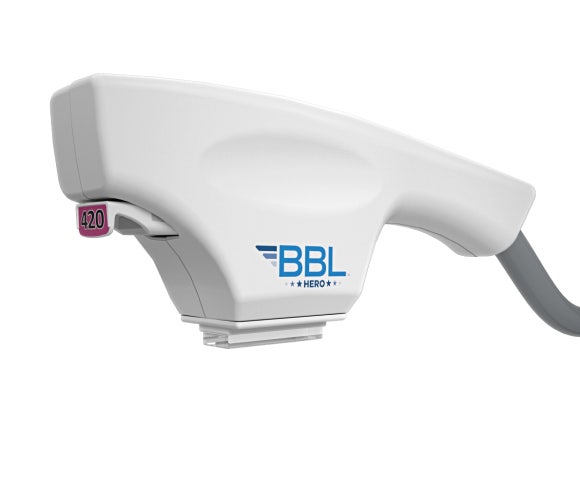 How BBL Laser in Apgujeong Improves Melasma and Spots, from Effects to Aftercare image 7