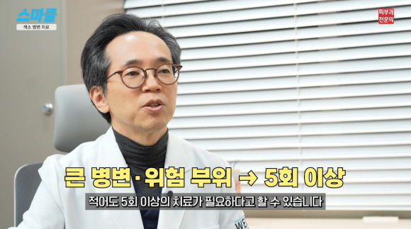 주근깨, 기미, 흑자 색소치료는 이렇게 받아야 합니다. <피부과 전문의> 관련 이미지 8
