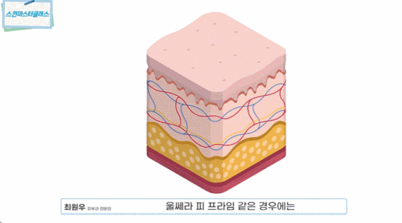 울쎄라 수면마취, 정말 필요할까요? 23년 차 피부과 전문의가 솔직하게 말씀드립니다. 관련 이미지 6