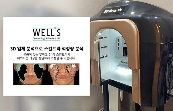 압구정 스컬트라 효과와 원리가 궁금하다면? 관련 이미지 4