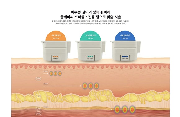 압구정 울쎄라 600샷보다 중요한 효과 볼 수 있는 3가지 방법 관련 이미지 4
