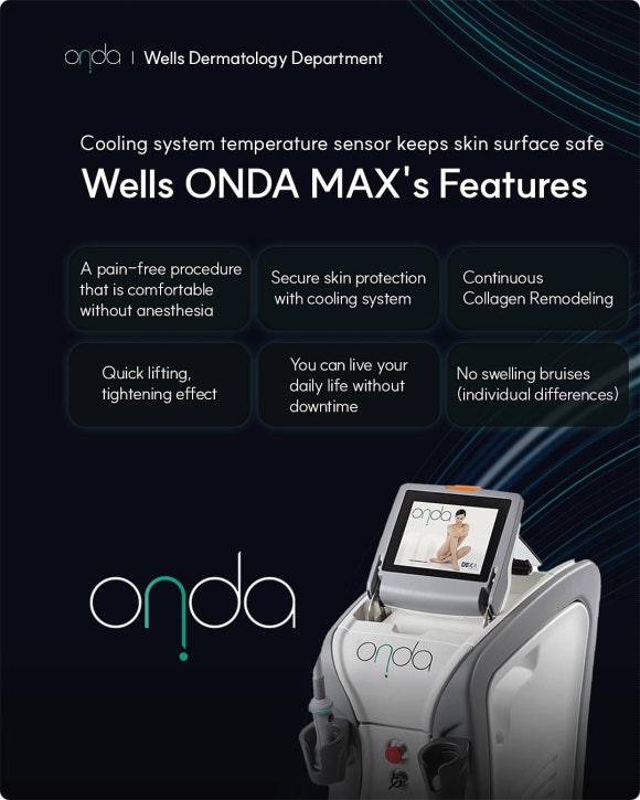 Onda MAX: What Matters More Than Strong Pulling Lifts Is the Balance of the Facial Line image 4