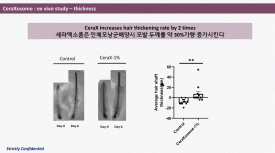 탈모 치료? 실제 임상 결과를 기반으로 설명드립니다. <세라엑소좀, 디톨로지 NMN> 관련 이미지 8