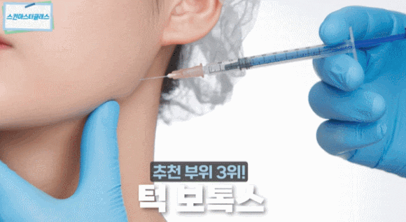 3 Recommended Areas for Botox and How to Receive Treatment Without Side Effects <Advice from a Dermatologist with 23 Years of Experience> image 5