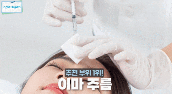 3 Recommended Areas for Botox and How to Receive Treatment Without Side Effects <Advice from a Dermatologist with 23 Years of Experience> image 3