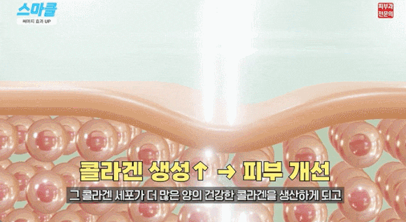 써마지 FLX만 n만 번째, 피부과 전문의가 알려주는 효과 좋은 방법 관련 이미지 7