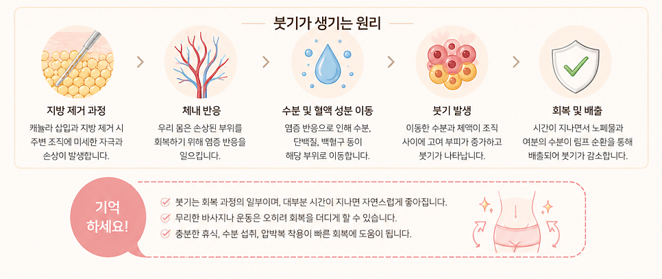 지방흡입붓기 언제 빠질까? 1주&middot;1개월&middot;3개월 회복 과정 정리 관련 이미지 6