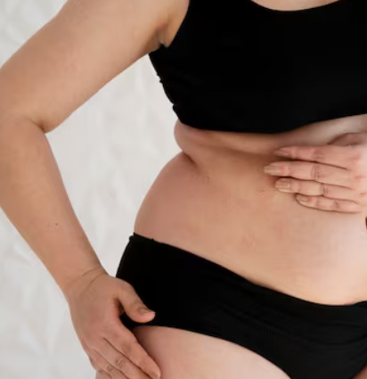 What to Check If You Are Concerned About Unevenness After Back Liposuction image 8