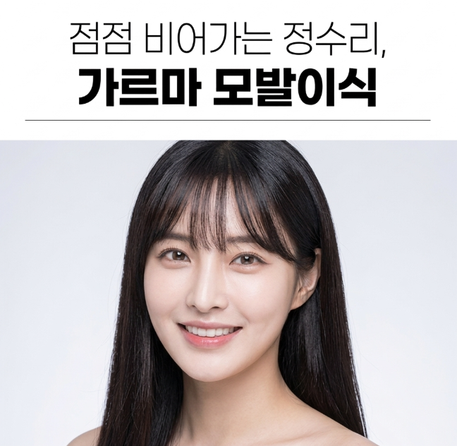 강남 성형외과 가르마모발이식 후기 많은데 왜 결과는 다를까? 핵심 차이 정리 관련 이미지 3