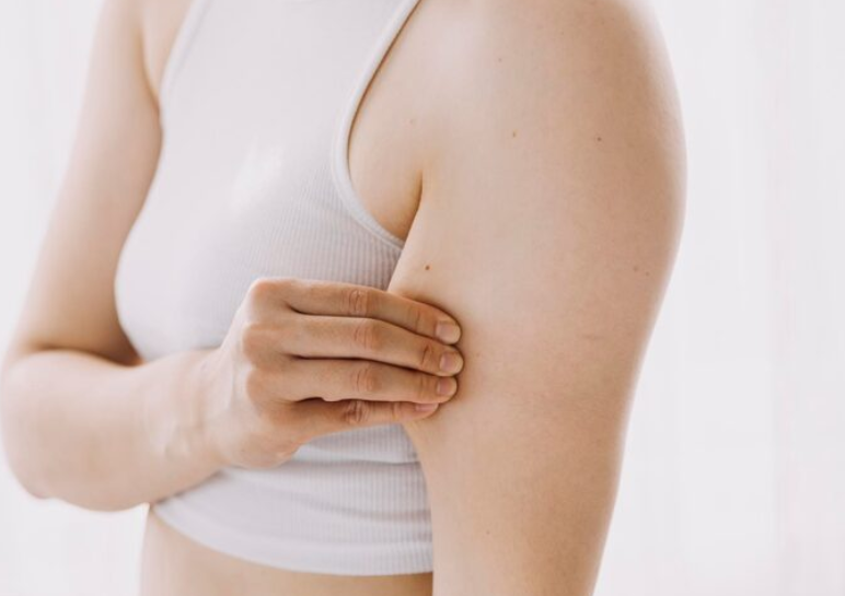 지방흡입재수술, 울퉁불퉁한 라인 다시 매끈해질 수 있을까? 관련 이미지 4