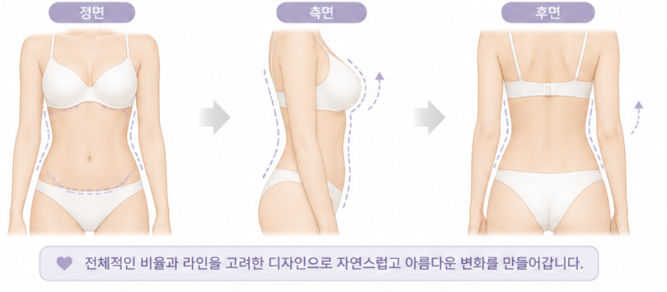 가슴지방이식가격, 같은 시술인데 비용이 다른 이유 관련 이미지 10